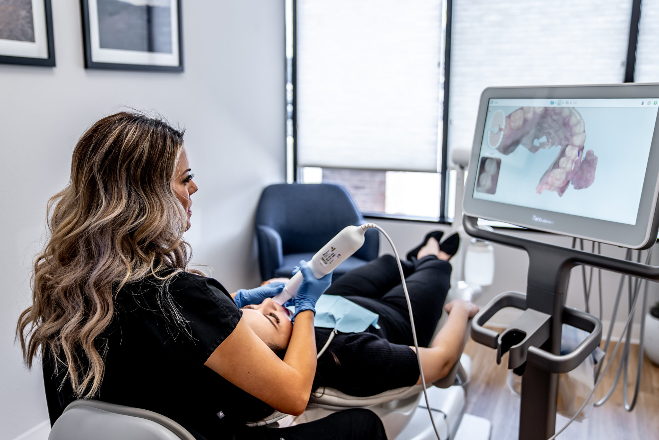 iTero Scanners for dental impressions
